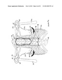 INTER-SCAPULAR BOLSTER diagram and image