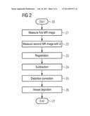 CONTRAST AGENT-FREE MR ANGIOGRAPHY WITH SSFP SEQUENCES diagram and image