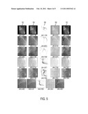 System and Method for Coronary Digital Subtraction Angiography diagram and image