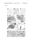 Treatment of HIV-1-infected individuals to reduce risk of coronary artery disease and suppress virus replication diagram and image