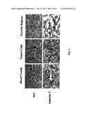 Methods For Treating Diseases Using Antibodies to Aminophospolipids diagram and image