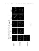 Methods For Treating Diseases Using Antibodies to Aminophospolipids diagram and image