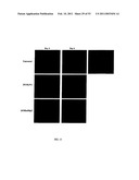 Methods For Treating Diseases Using Antibodies to Aminophospolipids diagram and image