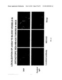 Methods For Treating Diseases Using Antibodies to Aminophospolipids diagram and image