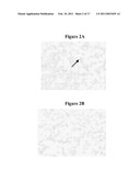 Methods For Inhibiting The Binding Of Endosialin To Ligands diagram and image