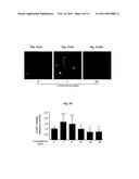 AGENTS AND METHODS FOR TREATMENT OF ANXIETY DISORDERS diagram and image