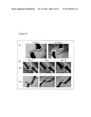 METHODS AND COMPOSITIONS FOR BONE HEALING BY PERIOSTIN diagram and image
