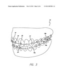 ORTHODONTIC BRACKET SYSTEM AND METHOD diagram and image