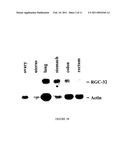 RESPONSE GENE TO COMPLEMENT 32 (RGC-32) IN DISEASE diagram and image