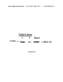 RESPONSE GENE TO COMPLEMENT 32 (RGC-32) IN DISEASE diagram and image