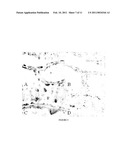 RESPONSE GENE TO COMPLEMENT 32 (RGC-32) IN DISEASE diagram and image