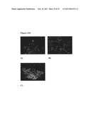 Oxyntomodulin for Preventing or Treating Excess Weight diagram and image