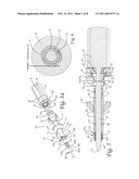 Surgical Retention Port and Method of Use diagram and image