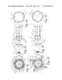 Surgical Retention Port and Method of Use diagram and image