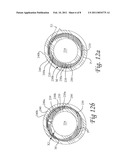 Surgical Retention Port and Method of Use diagram and image