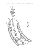 PLAQUE TYPE DETERMINATION DEVICES, SYSTEMS, AND METHODS diagram and image