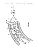 PLAQUE TYPE DETERMINATION DEVICES, SYSTEMS, AND METHODS diagram and image