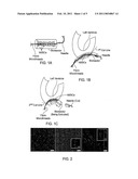 MICROTHREAD DELIVERY SYSTEM diagram and image