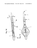 CATHETER PUMP FOR CIRCULATORY SUPPORT diagram and image