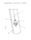 CATHETER PUMP FOR CIRCULATORY SUPPORT diagram and image