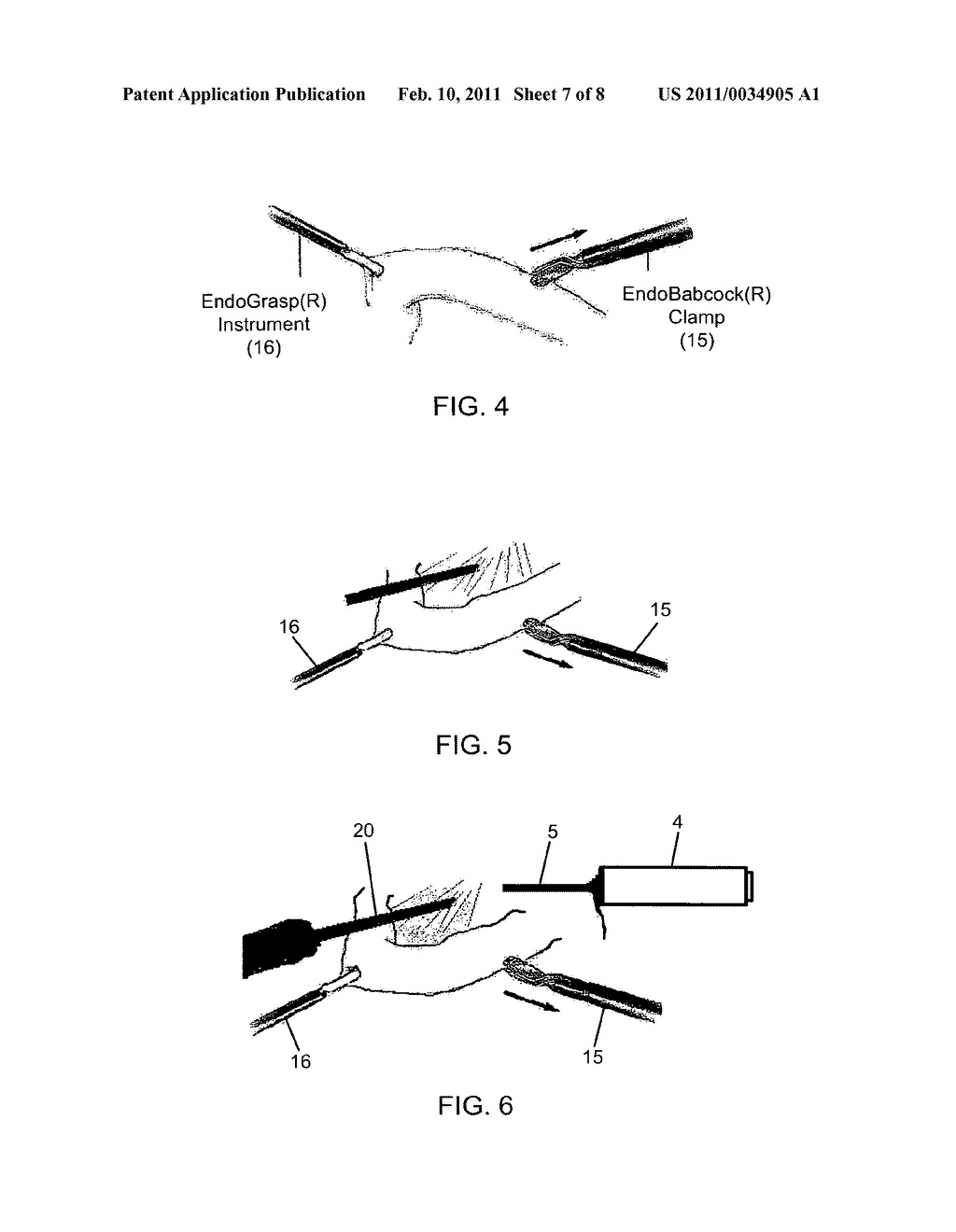 Method of and apparatus for treating abdominal obesity and metabolic syndrome in human patients - diagram, schematic, and image 08