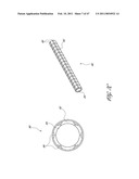 SYSTEMS FOR TREATING A HOLLOW ANATOMICAL STRUCTURE diagram and image