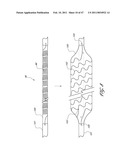 SYSTEMS FOR TREATING A HOLLOW ANATOMICAL STRUCTURE diagram and image