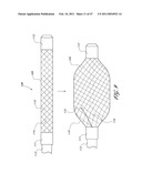 SYSTEMS FOR TREATING A HOLLOW ANATOMICAL STRUCTURE diagram and image