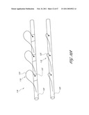 SYSTEMS FOR TREATING A HOLLOW ANATOMICAL STRUCTURE diagram and image