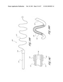 SYSTEMS FOR TREATING A HOLLOW ANATOMICAL STRUCTURE diagram and image