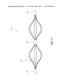 SYSTEMS FOR TREATING A HOLLOW ANATOMICAL STRUCTURE diagram and image