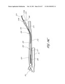 SYSTEMS FOR TREATING A HOLLOW ANATOMICAL STRUCTURE diagram and image