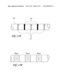 SYSTEMS FOR TREATING A HOLLOW ANATOMICAL STRUCTURE diagram and image