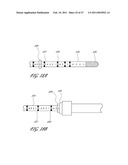 SYSTEMS FOR TREATING A HOLLOW ANATOMICAL STRUCTURE diagram and image