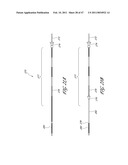 SYSTEMS FOR TREATING A HOLLOW ANATOMICAL STRUCTURE diagram and image