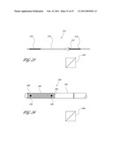 SYSTEMS FOR TREATING A HOLLOW ANATOMICAL STRUCTURE diagram and image