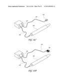 SYSTEMS FOR TREATING A HOLLOW ANATOMICAL STRUCTURE diagram and image