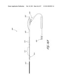 SYSTEMS FOR TREATING A HOLLOW ANATOMICAL STRUCTURE diagram and image