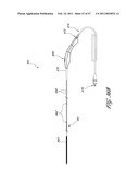 SYSTEMS FOR TREATING A HOLLOW ANATOMICAL STRUCTURE diagram and image