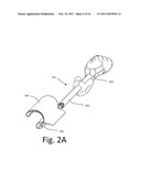 DEVICE AND METHOD FOR ROLLING AND INSERTING A PROSTHETIC PATCH INTO A BODY CAVITY diagram and image