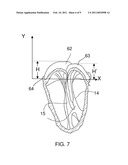 ANNULOPLASTY TUBES diagram and image