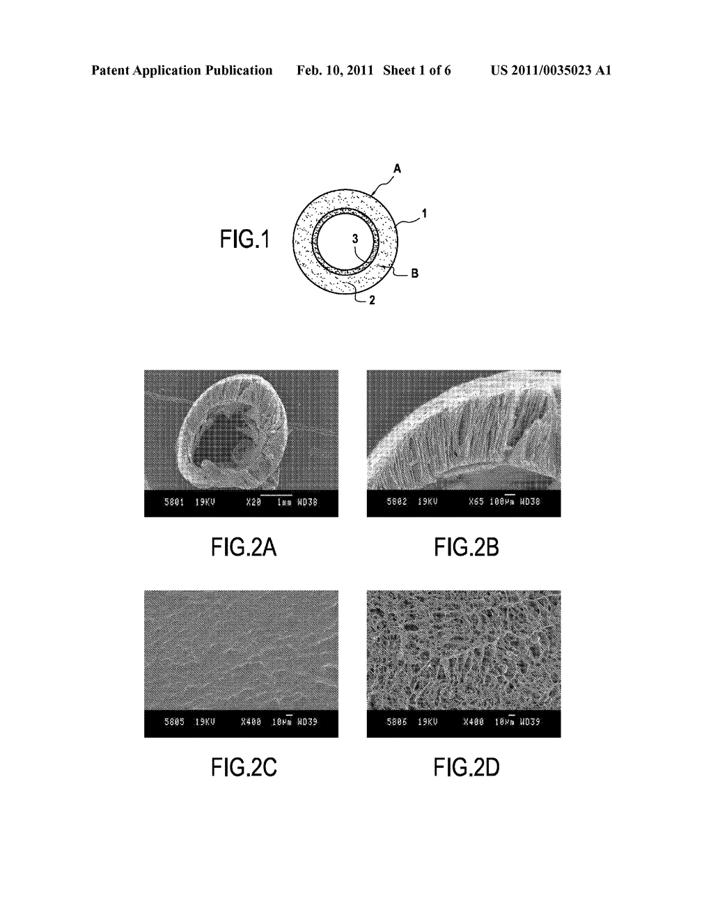 PROSTHESIS FOR PROMOTING THE IN VIVO RECONSTRUCTION OF A HOLLOW ORGAN OR A PORTION OF A HOLLOW ORGAN - diagram, schematic, and image 02