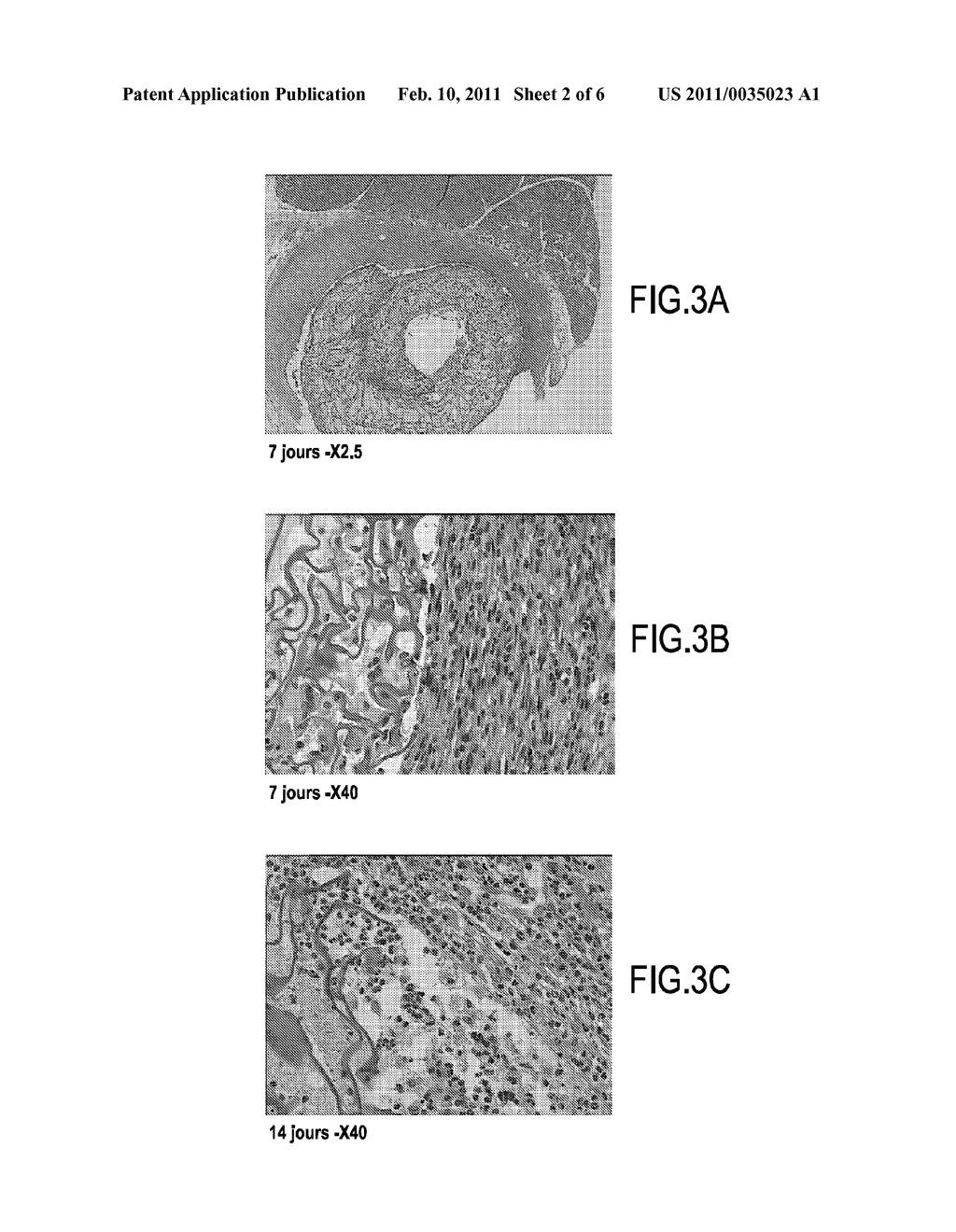 PROSTHESIS FOR PROMOTING THE IN VIVO RECONSTRUCTION OF A HOLLOW ORGAN OR A PORTION OF A HOLLOW ORGAN - diagram, schematic, and image 03