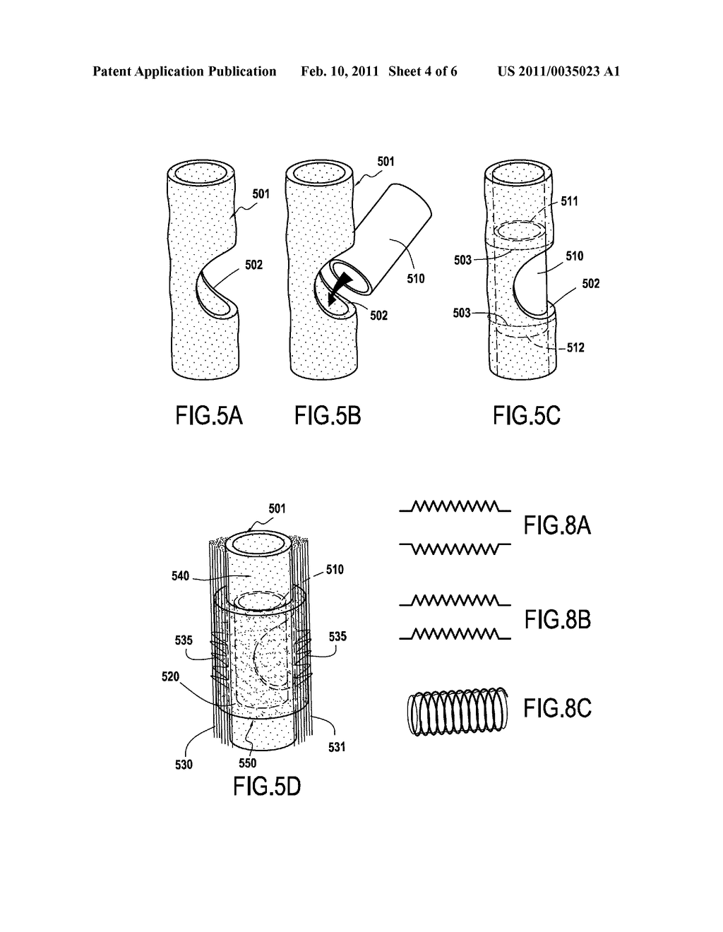 PROSTHESIS FOR PROMOTING THE IN VIVO RECONSTRUCTION OF A HOLLOW ORGAN OR A PORTION OF A HOLLOW ORGAN - diagram, schematic, and image 05