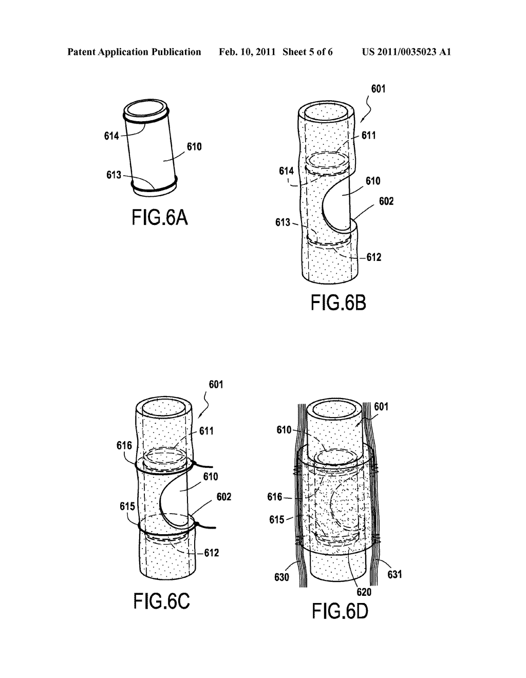 PROSTHESIS FOR PROMOTING THE IN VIVO RECONSTRUCTION OF A HOLLOW ORGAN OR A PORTION OF A HOLLOW ORGAN - diagram, schematic, and image 06