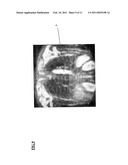 IMAGING TECHNIQUE diagram and image