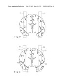 Magnetic resonance imaging apparatus and magnetic resonance imaging method diagram and image