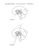 Magnetic resonance imaging apparatus and magnetic resonance imaging method diagram and image