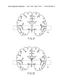 Magnetic resonance imaging apparatus and magnetic resonance imaging method diagram and image