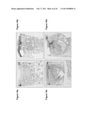 MATRIX COMPOSED OF A NATURALLY-OCCURRING PROTEIN BACKBONE CROSS LINKED BY A SYNTHETIC POLYMER AND METHODS OF GENERATING AND USING SAME diagram and image